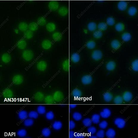 Recombinant Kappa light chain Monoclonal Antibody - 2