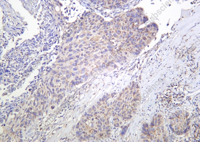 Recombinant Bim Monoclonal Antibody - 2
