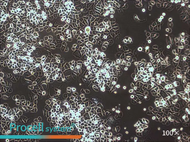 AU565 Cell Complete Medium - 2