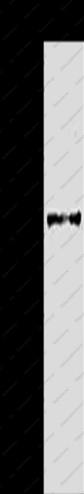 AKR1B1 Polyclonal Antibody - 1