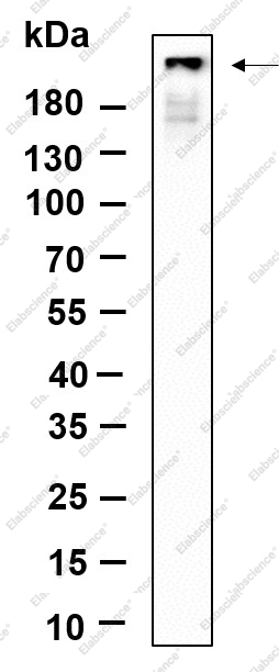 Recombinant Phospho-IRF3 (Ser396) Monoclonal Antibody - 1