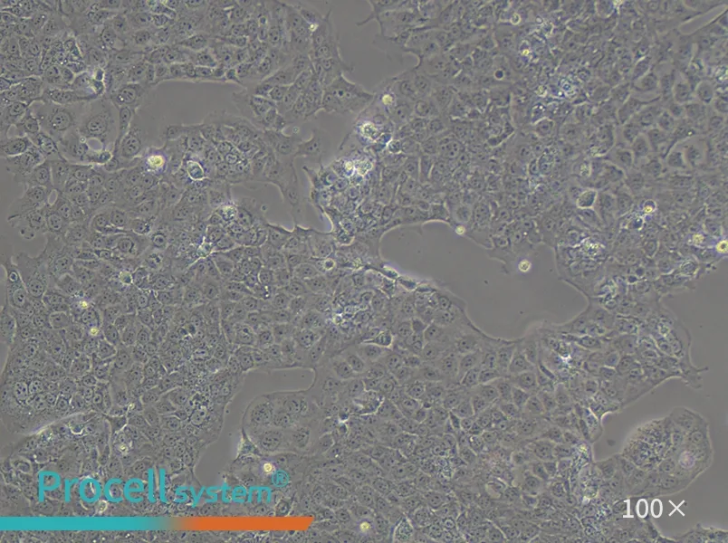 JEG-3 Cell Complete Medium - 2