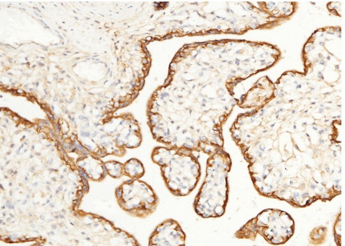Recombinant CD147/EMMPRIN/Basigin Monoclonal Antibody - small - 6
