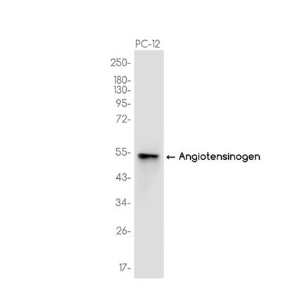 Recombinant Angiotensinogen/AGT Monoclonal Antibody - 1