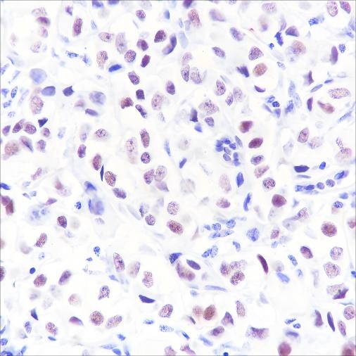 Recombinant MED4 Monoclonal Antibody - 2