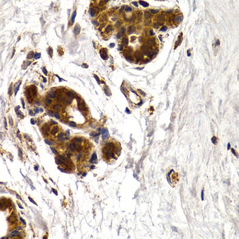 Immunohistochemistry of paraffin-embedded Human mammary gland using CTSS Polyclonal Antibody at dilution of 1:200 (40x lens).