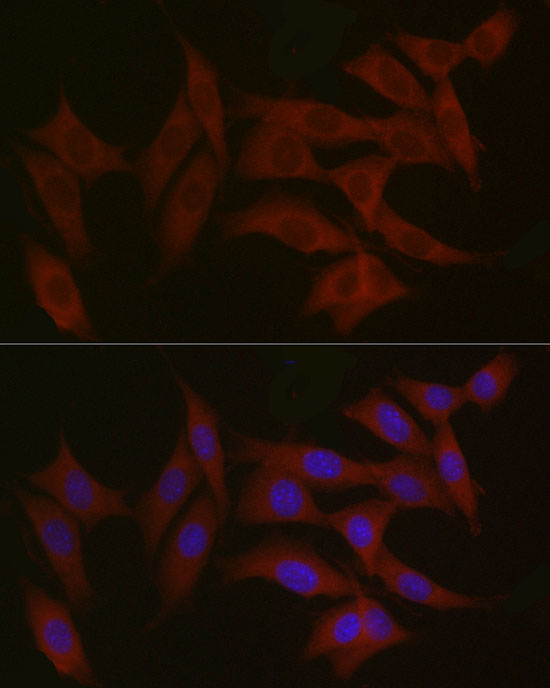 Immunofluorescence analysis of NIH/3T3 cells using TYK2 Polyclonal Antibody at dilution of 1:100 (40x lens). Blue: DAPI for nuclear staining.