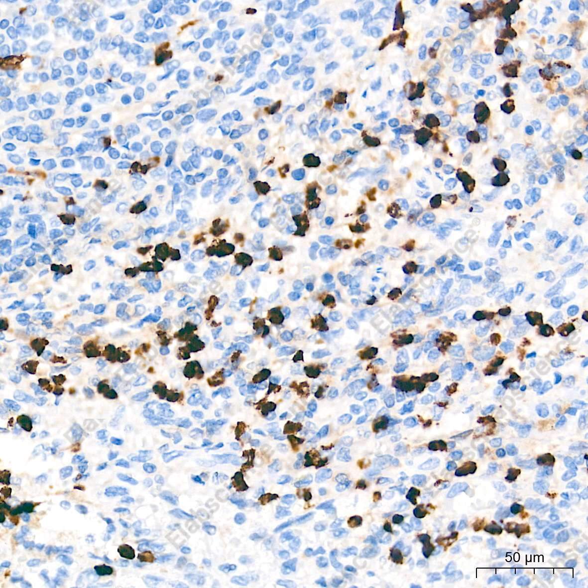 MMP9 Polyclonal Antibody - 5