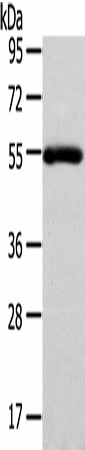 Western Blot analysis of Human normal liver tissue using FOXC1 Polyclonal Antibody at dilution of 1/400