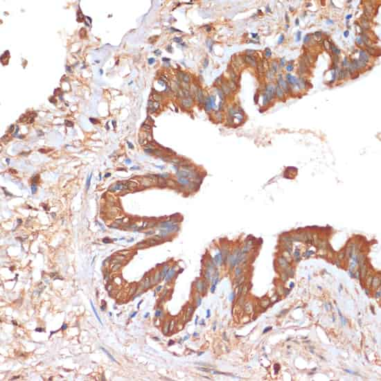 Immunohistochemistry of paraffin-embedded Human lung using HHLA2 Polyclonal Antibody at dilution of  1:100 (40x lens).