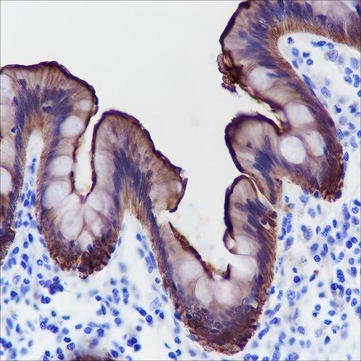 Recombinant Villin Monoclonal Antibody - 2