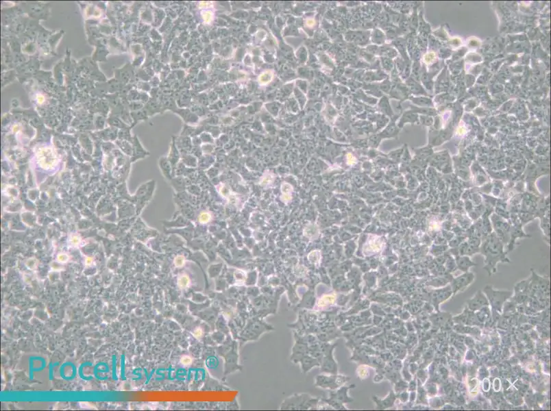 NCI-H520 Cell Complete Medium - small - 6