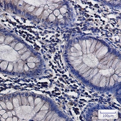 Recombinant ATP6V0D1 Monoclonal Antibody - 4