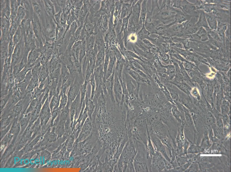 hTERT-HPNE - 4