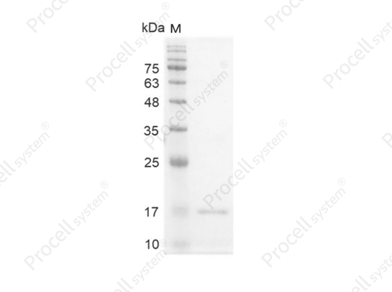 Interferon &gamma;/IFN-&gamma;/IFNG, Human, Recombinant