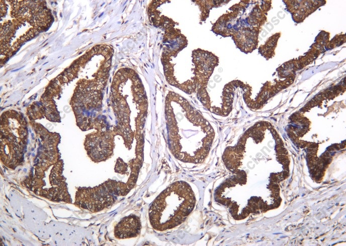 Recombinant ANXA5 Monoclonal Antibody - 1
