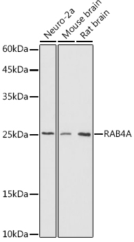 Western blot analysis of extracts of various cell lines using RAB4A Polyclonal Antibody at 1:500 dilution.