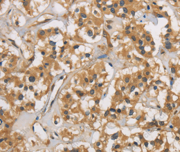 CASP3 Polyclonal Antibody - 3