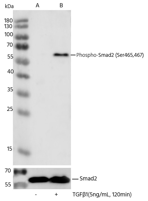 Recombinant Phospho-SMAD2 (Ser465, 467) Monoclonal Antibody - small - 1