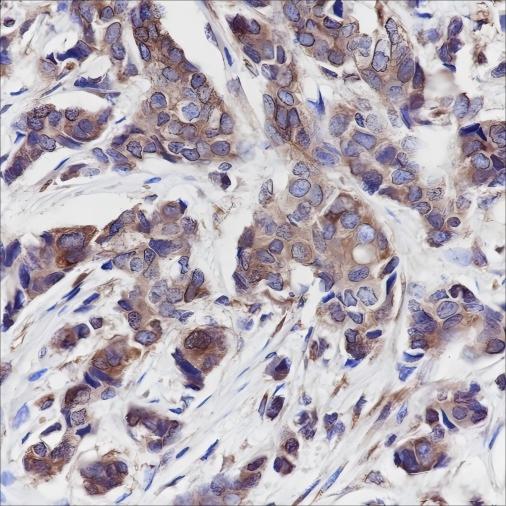 Recombinant Calpastatin Monoclonal Antibody - small - 2