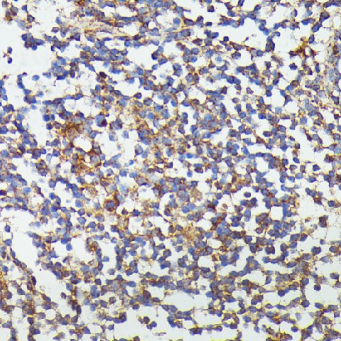 Immunohistochemistry of paraffin-embedded Human colon using CSF3 Polyclonal Antibody at dilution of  1:100 (40x lens).