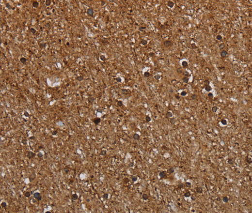 Immunohistochemistry of paraffin-embedded Human brain  tissue using MT-ND1 Polyclonal Antibody at dilution 1:30