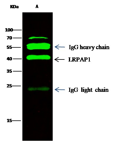 Recombinant LRPAP1/A2MRAP Monoclonal Antibody - small - 2