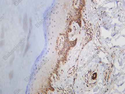 Recombinant UBC9 Monoclonal Antibody - 1