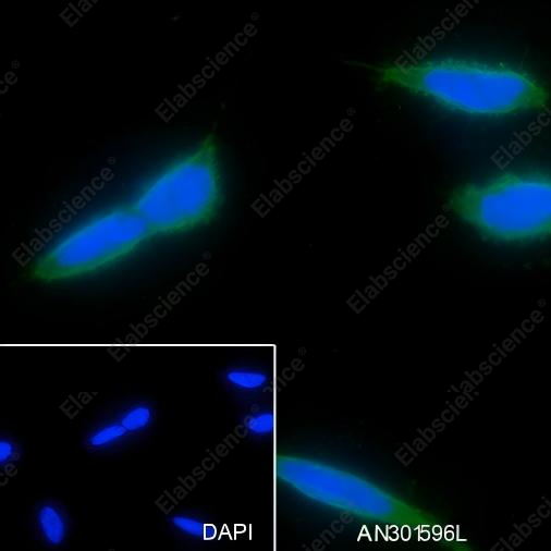 Recombinant MAP1LC3A Monoclonal Antibody - 3
