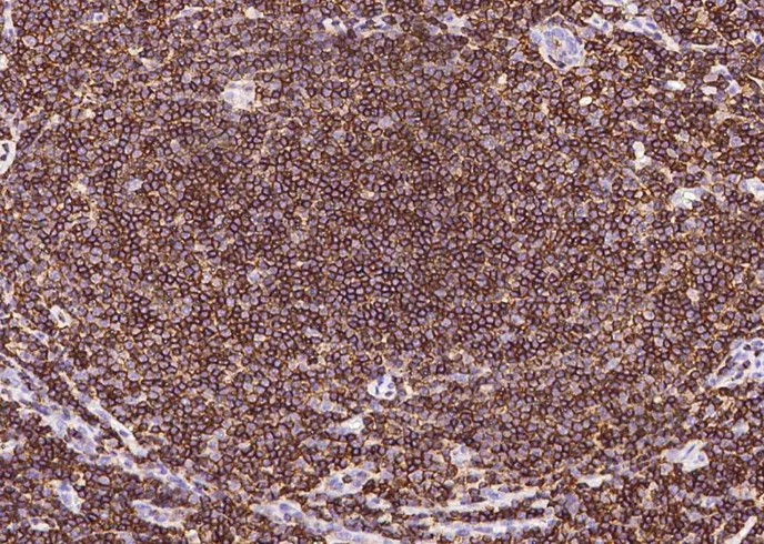 CD45/Ptprc Monoclonal Antibody - small - 3