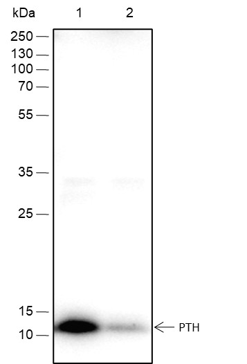 Recombinant PTH Monoclonal Antibody-searchlist-1