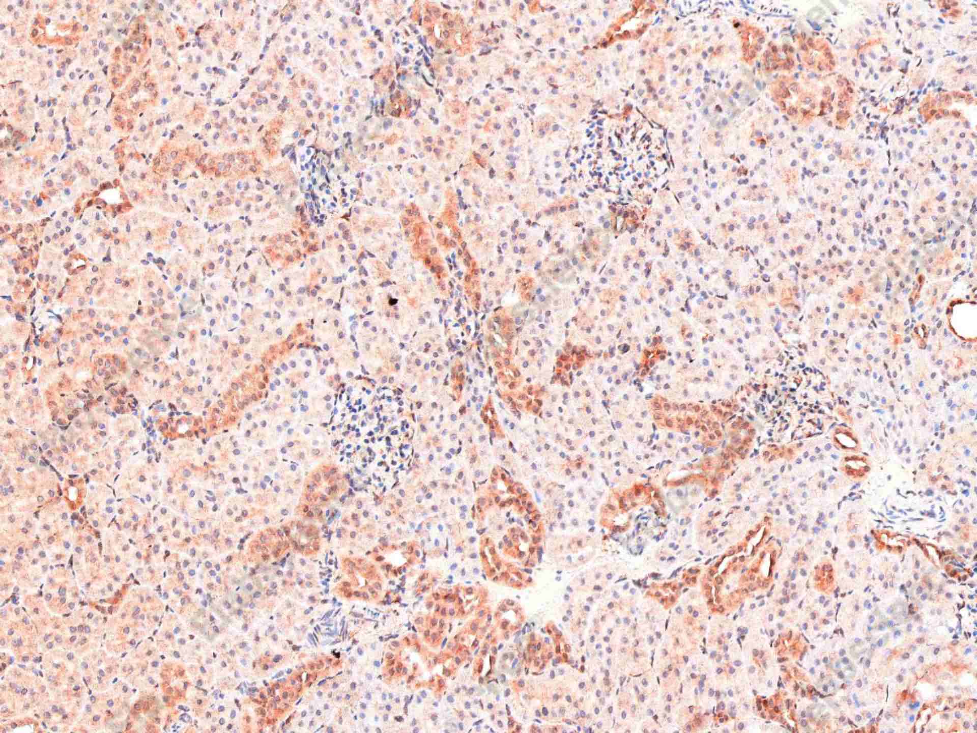 Recombinant Akt (pan) Monoclonal Antibody - 1