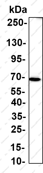 Recombinant SOX11 Monoclonal Antibody - 1