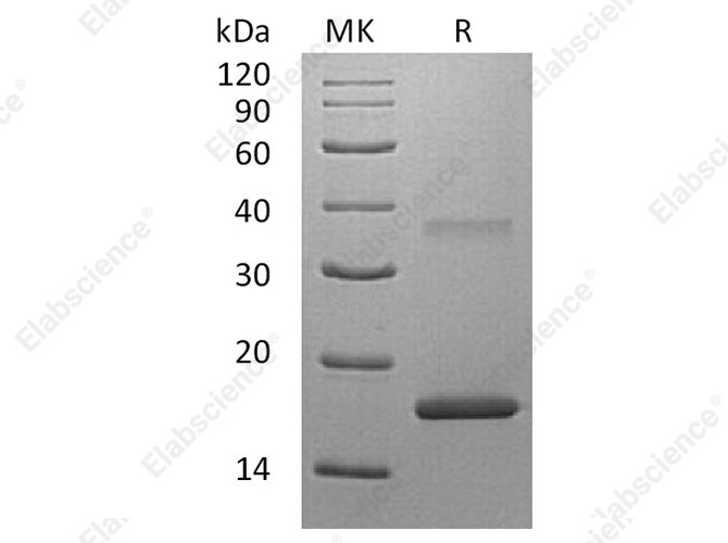 Recombinant Human Interleukin-7/IL-7 Protein - 1