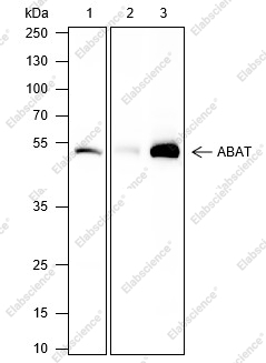 Recombinant ABAT Monoclonal Antibody - 1