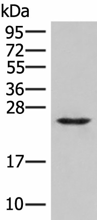 Western blot analysis of Human fetal brain tissue lysate  using MRAS Polyclonal Antibody at dilution of 1:400