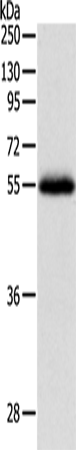 Western Blot analysis of Human leiomyosarcoma tissue using NPY1R Polyclonal Antibody at dilution of 1:400