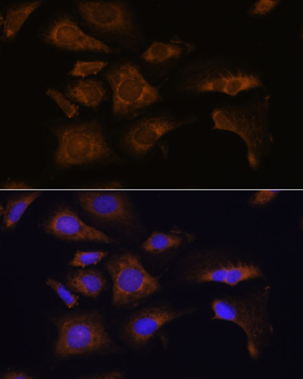 Immunofluorescence analysis of U-2 OS cells using RPS25 Polyclonal Antibody at dilution of  1:100. Blue: DAPI for nuclear staining.