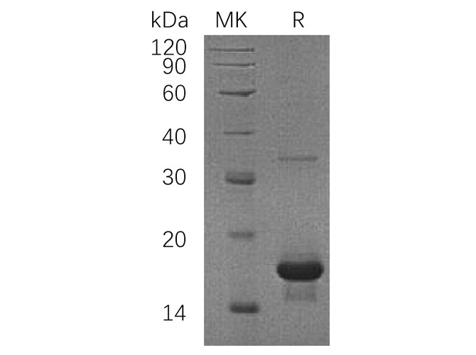 Recombinant Human SH2D1A/SAP Protein (His Tag)