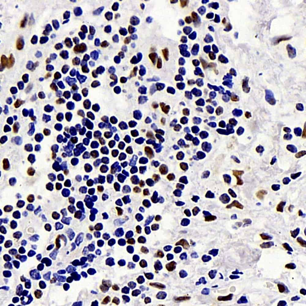 Immunohistochemistry analysis of paraffin-embedded human gallbladder  using c-Fos Monoclonal Antibody at dilution of 1:1000.