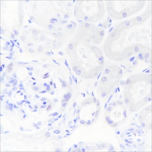 Recombinant hCG beta Monoclonal Antibody - 2