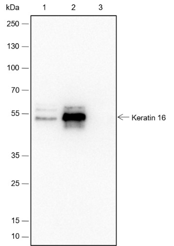 Recombinant Keratin 16 Monoclonal Antibody - small - 5