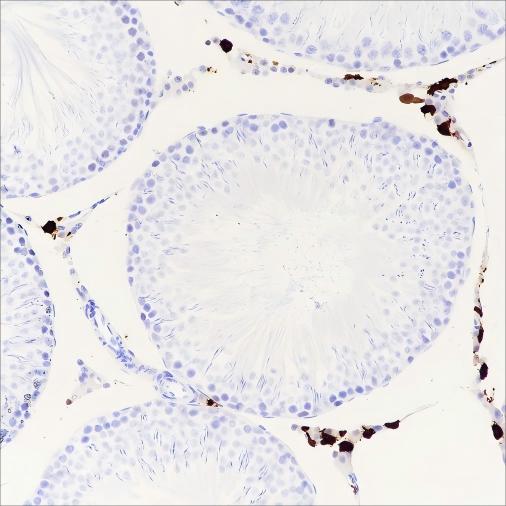 Recombinant Factor XIIIa Monoclonal Antibody - small - 5