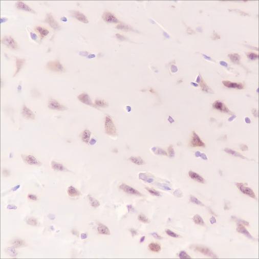 Recombinant WWOX Monoclonal Antibody - small - 4