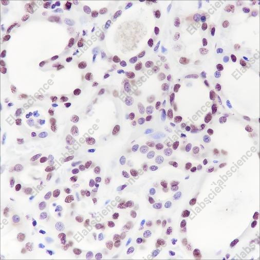 Recombinant HMGB1 Monoclonal Antibody - 2