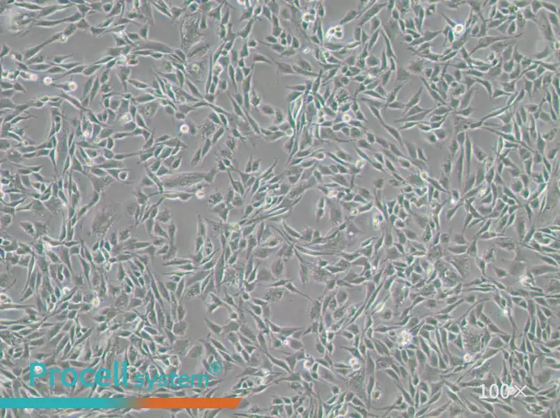 CCF-STTG1 Cell Complete Medium - 1