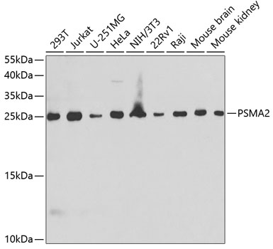 Western blot analysis of extracts of various cell lines using PSMA2 Polyclonal Antibody at 1:1000 dilution.