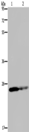 Western Blot analysis of HT-29 cell and Human fetal brain tissue using GSTP1 Polyclonal Antibody at dilution of 1:350