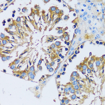 Immunohistochemistry of paraffin-embedded Mouse testis using CABP7 Polyclonal Antibody at dilution of 1:100 (40x lens).