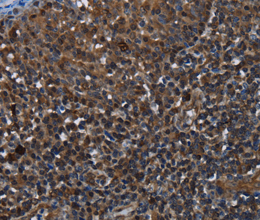 GALT Polyclonal Antibody - small - 2